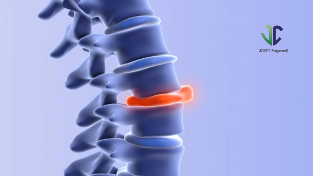 Physiotherapy session showing simple back exercises for disc bulge pain relief.